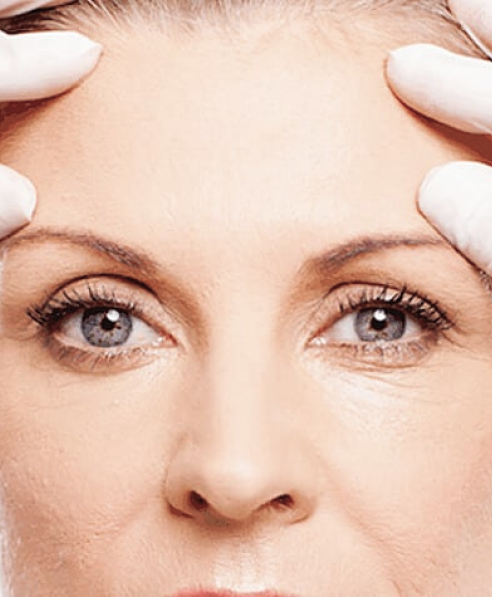 O que e Blefaroplastia